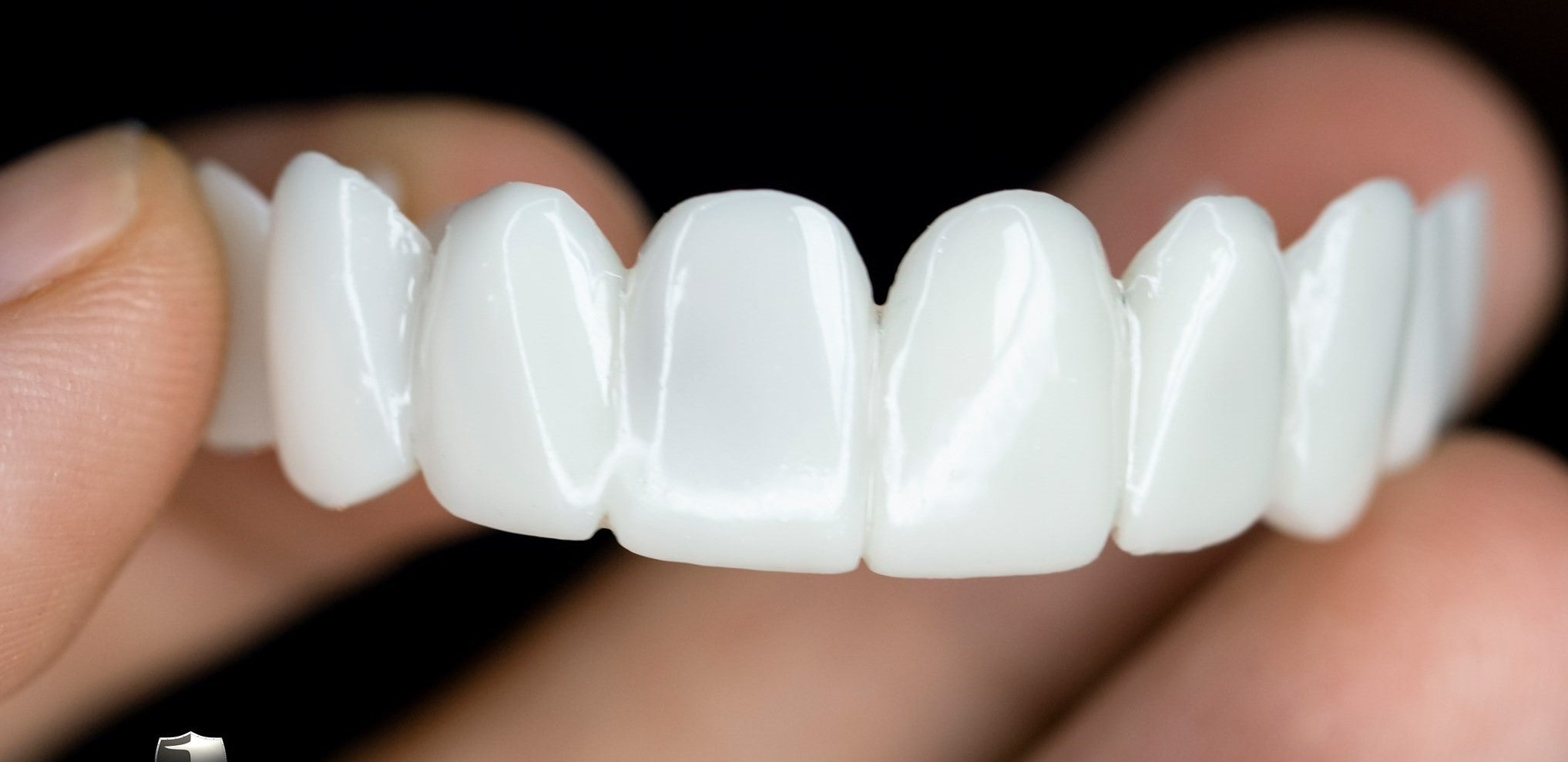 Junips | Snap-On Cosmetic Veneers | Instant Smile Cover for Imperfections