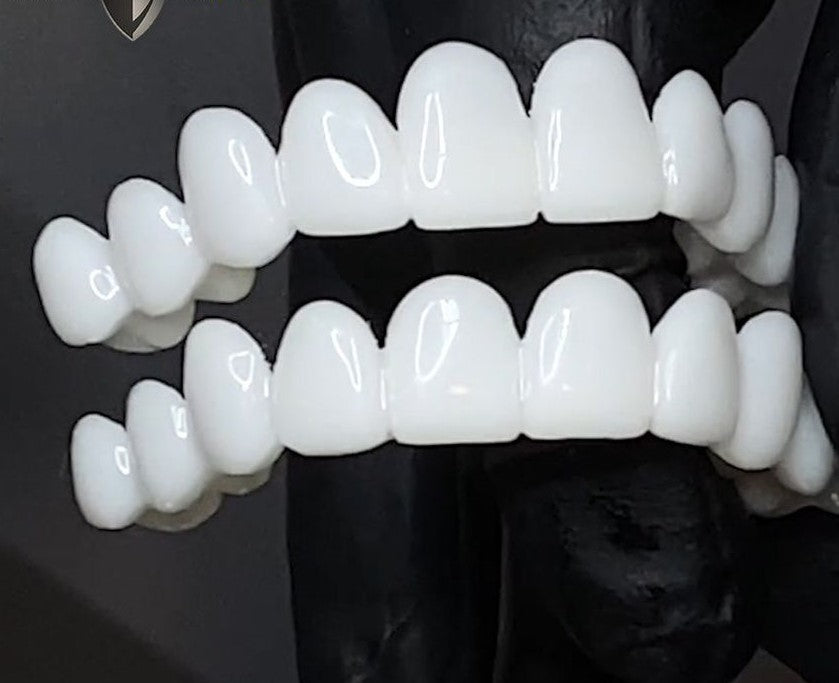 Junips | Snap-On Cosmetic Veneers | Instant Smile Cover for Imperfections