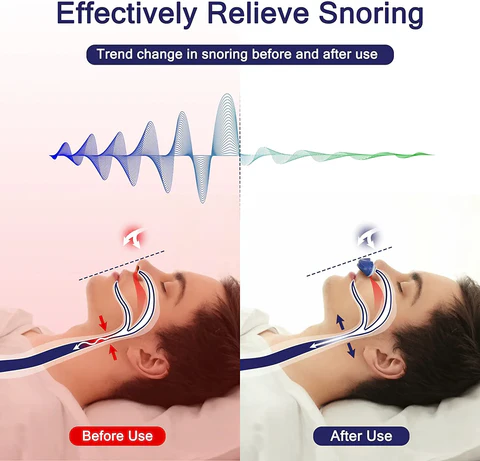 Junips | Micro CPAP Sleep Apnea Machine for Travel & Anti-Snoring - CPAP Alternative
